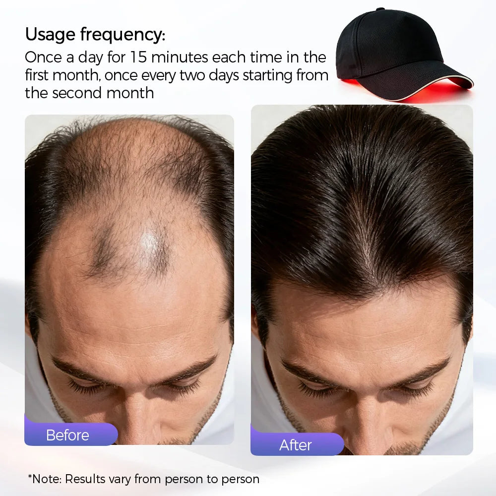 Redlumis Pro 210 — Red Light Therapy Hair Growth Cap |  210 LEDs | 470nm + 630nm + Infrared